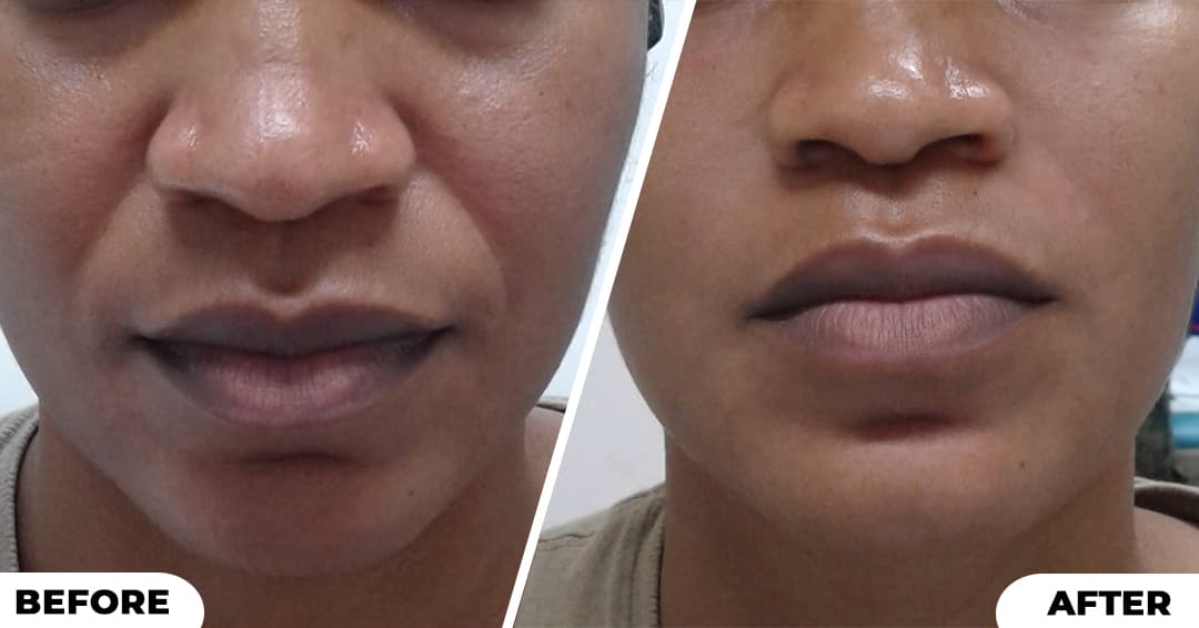 Want To Look Younger? - Aesthetic Treatments image