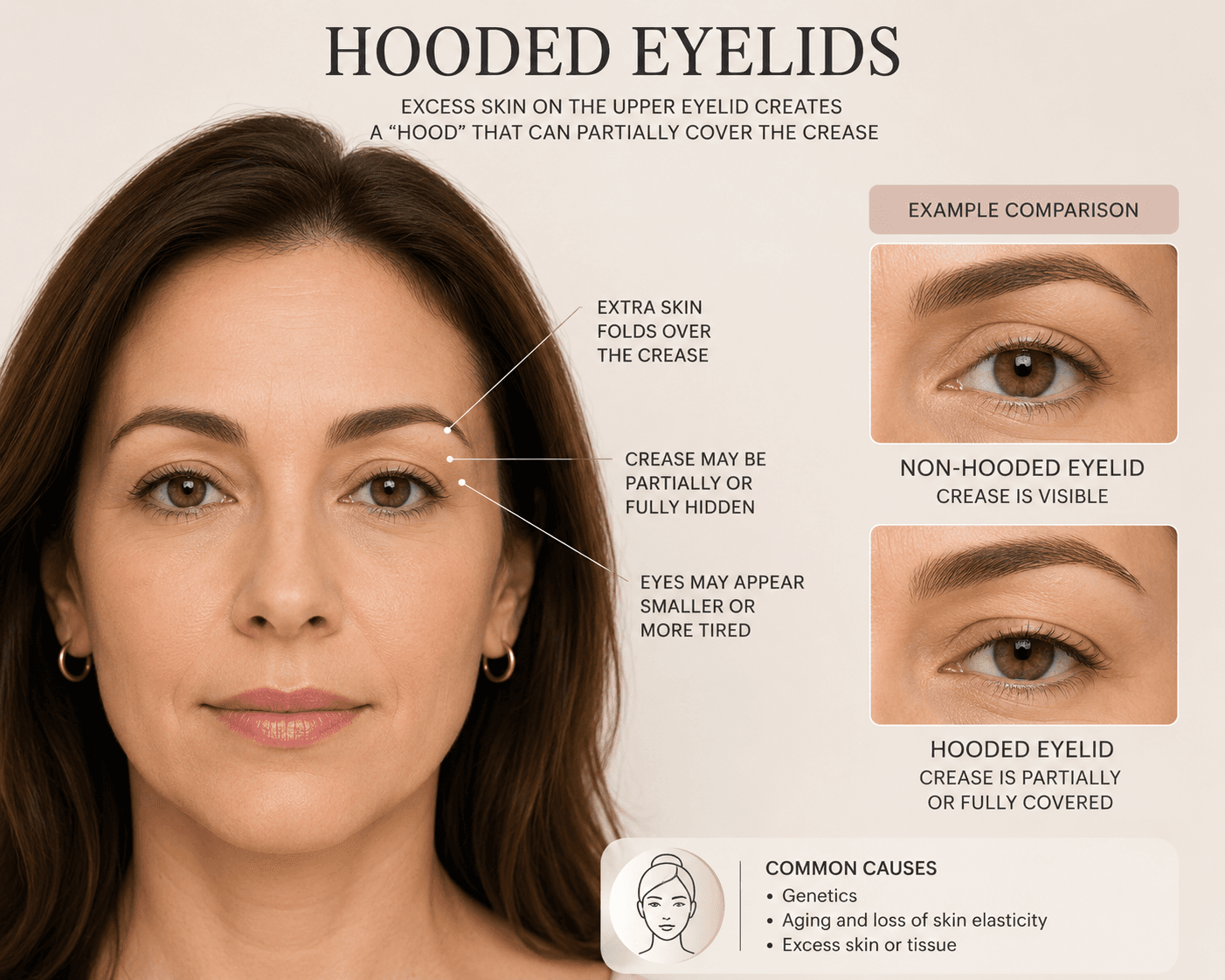 Hooded Eyelids Diagram