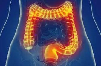 Gas, Bloating, Reflux or Bladder Leakage? image