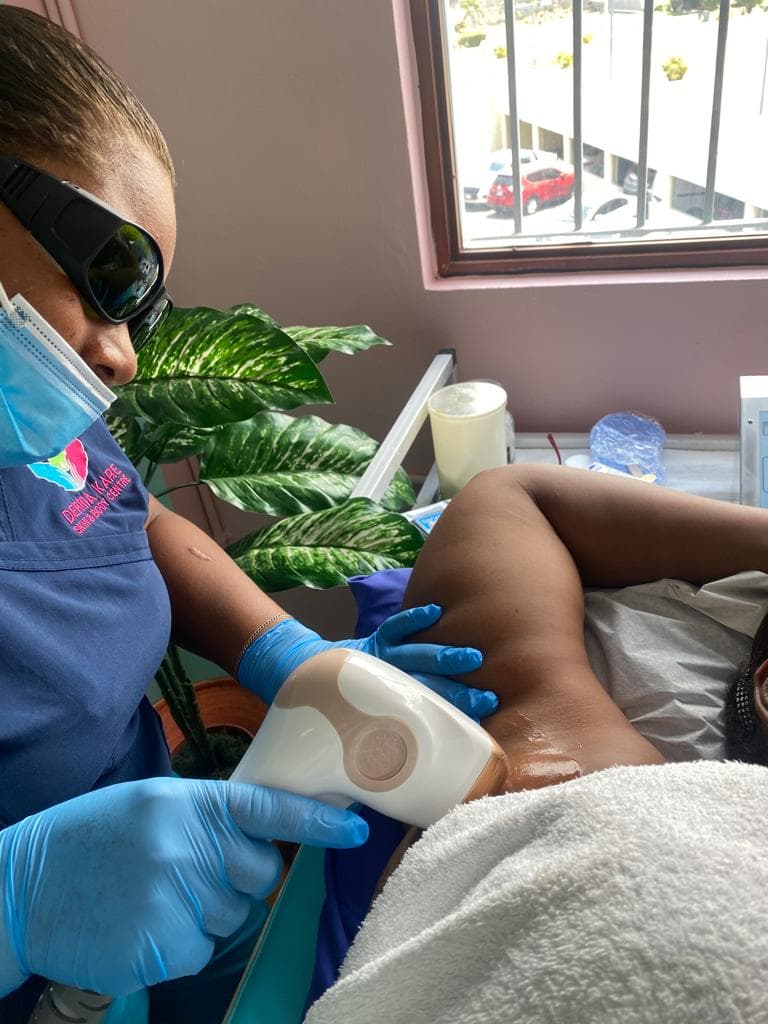 LASER HAIR REMOVAL