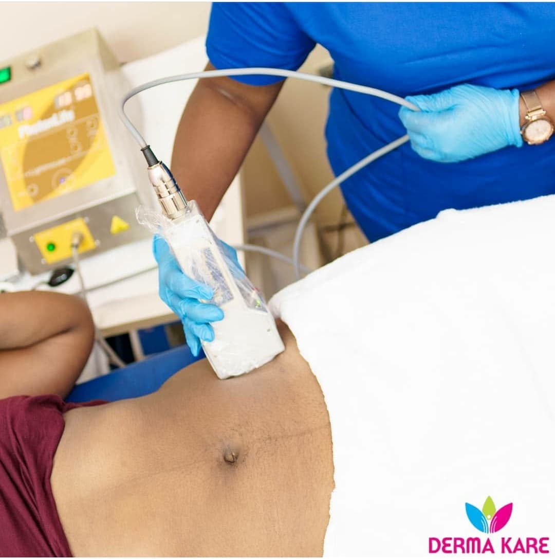 Laser Treatments